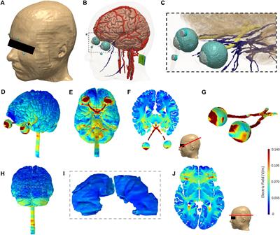 Safety Aspects, Tolerability and Modeling of Retinofugal Alternating Current Stimulation
